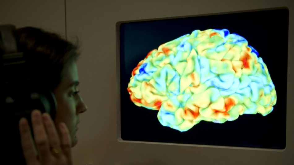 Scientists use brain scans and AI to 'decode' thoughts